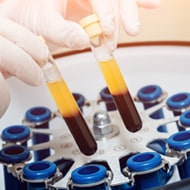 biopharma_plasma