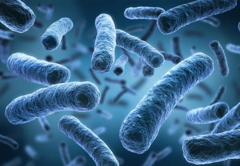 Legionella
